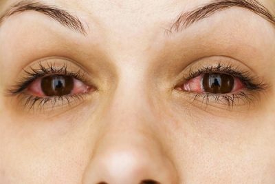 yeux rouge cannabis